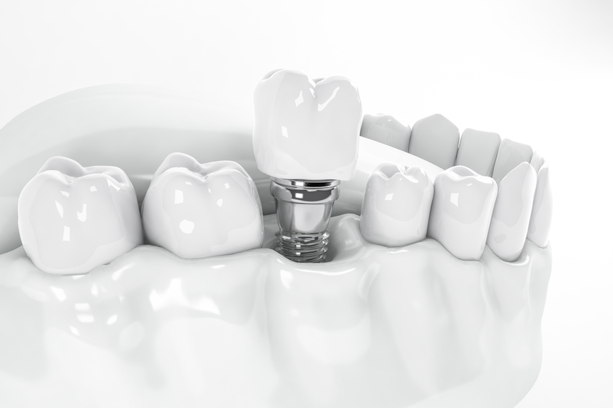 Fixed Artificial Teeth in Cidco Nashik
